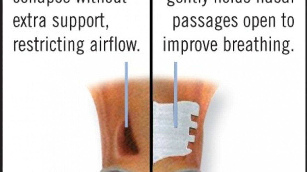 EIPH &amp; The Price Of Victory: Protecting Racehorse Lungs Image 2