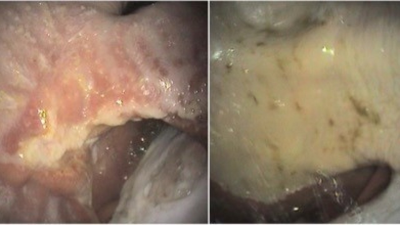 Preventing Stomach Ulcers In High-Performance Horses Image 3